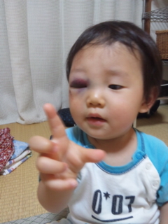 Kei お岩さんになる 天然 Smiley 生活 2